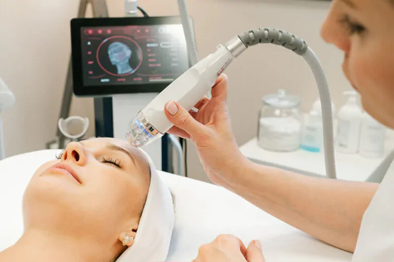 Radiorefraktiv Micro-needle Rf Lifting utan skalpell