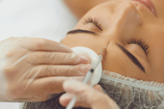 Vad är Relfydess Botox